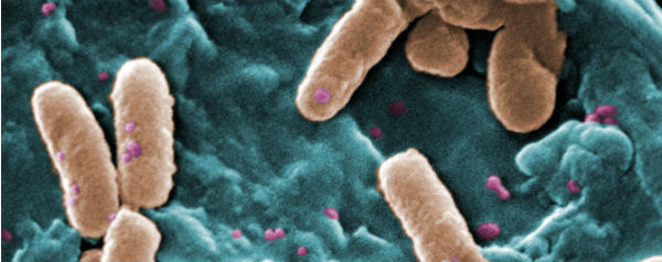 Bacterie Pseudomonas aeruginosa