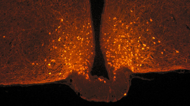 POMC neuronen