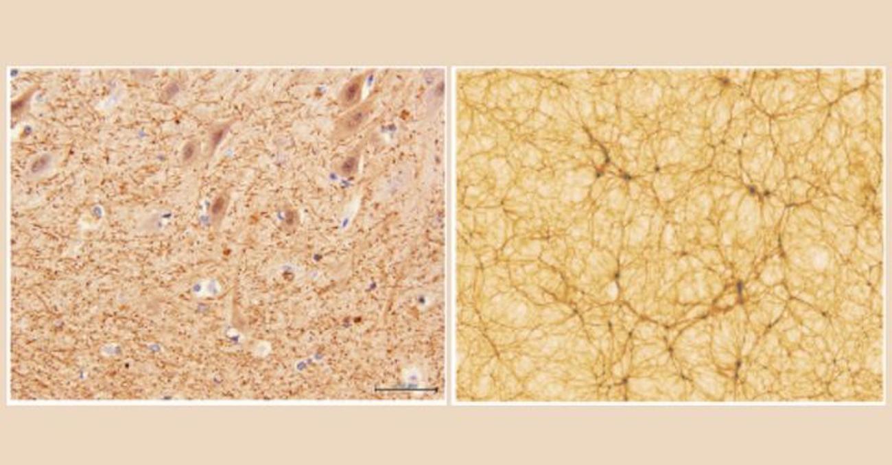 Netwerk in hersenen en heelal vergeleken