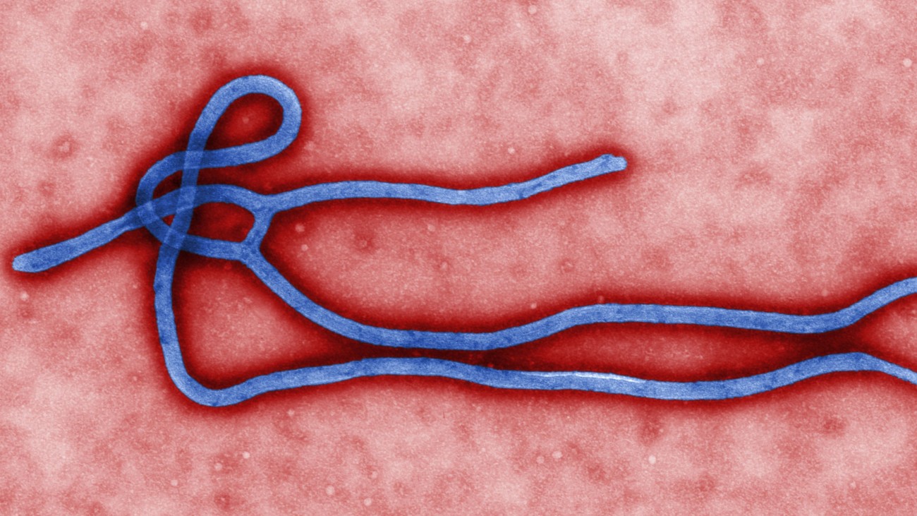 ebolavirus