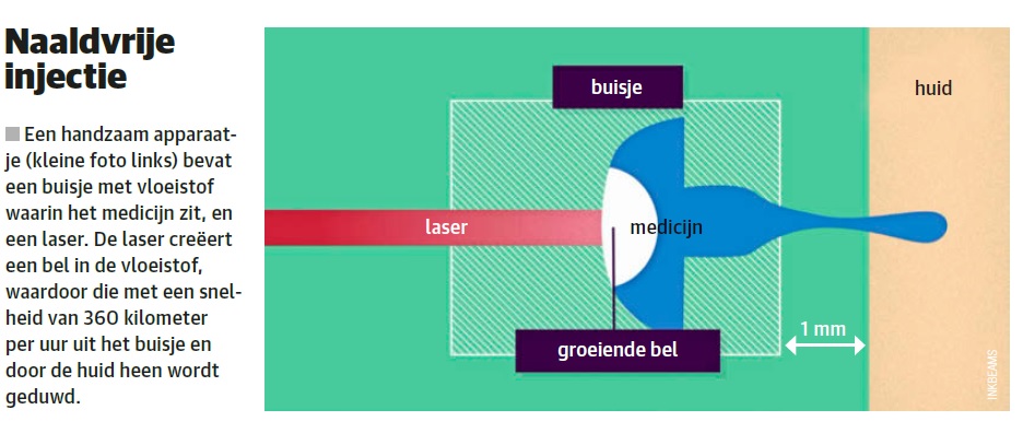 naaldvrije injecties