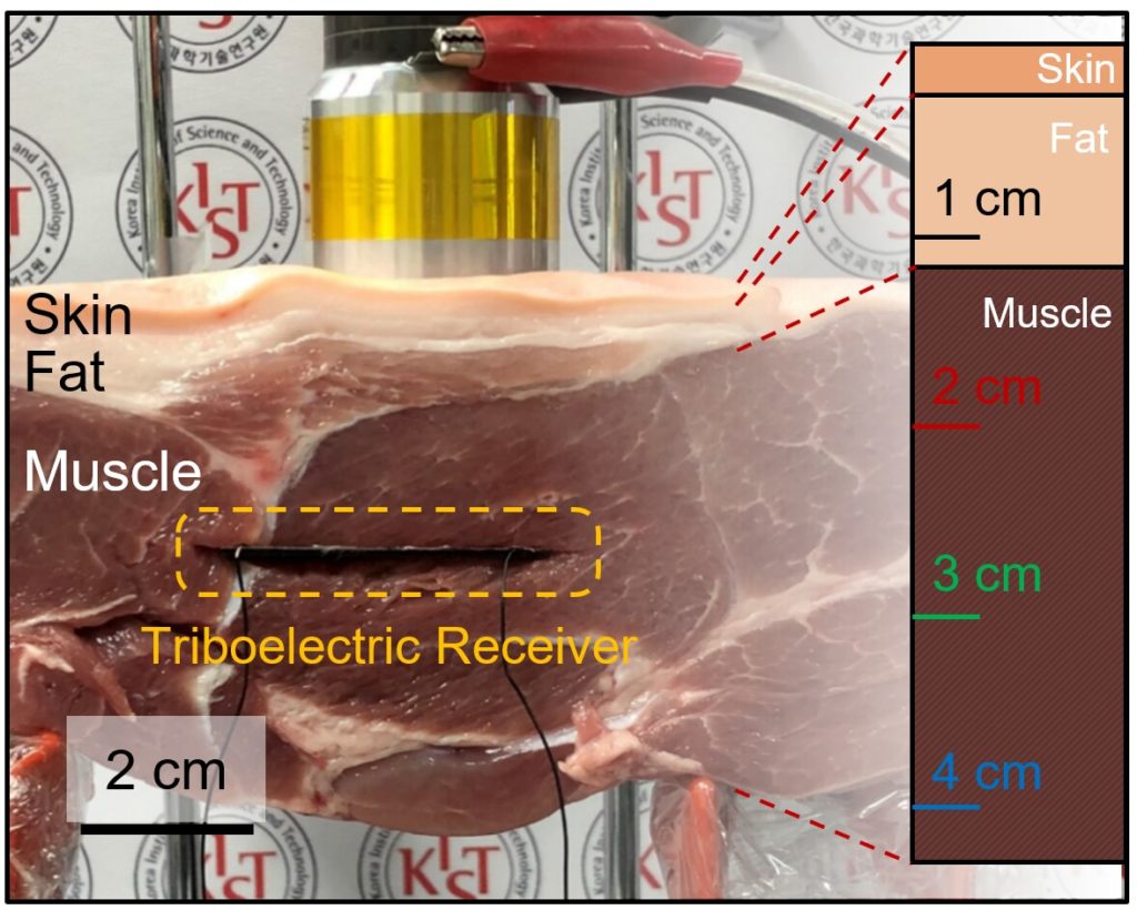 pacemaker