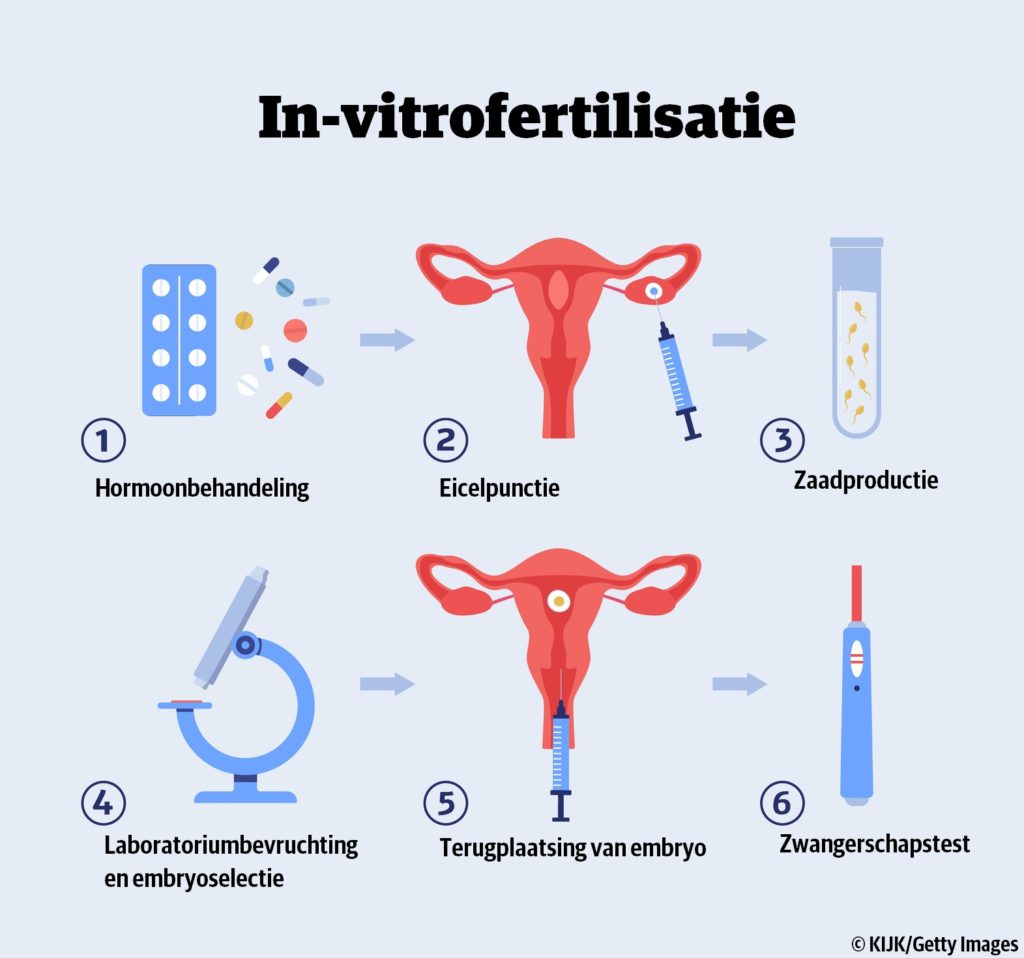 ivf uitgelegd