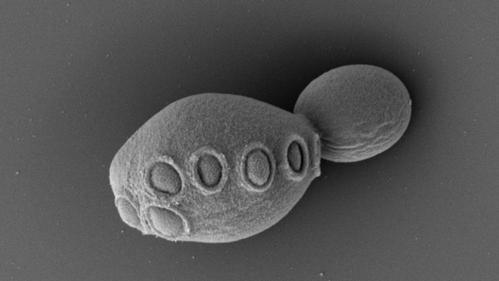 Elektronenfoto van gistcel met kunstmatig DNA